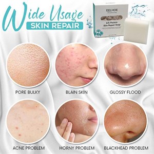 ELCHOE отбеливающее мыло для лица и тела от расширенных